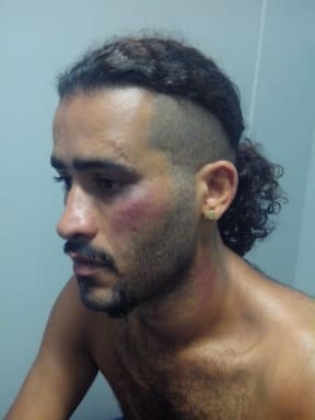 Iranian asylum seeker on Manus