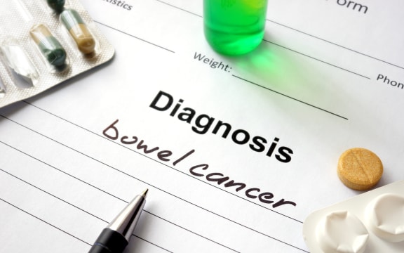 Bowel Cancer stock photo