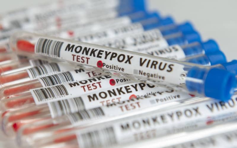 Wastewater testing for monkeypox being trialled in New Zealand's main ...