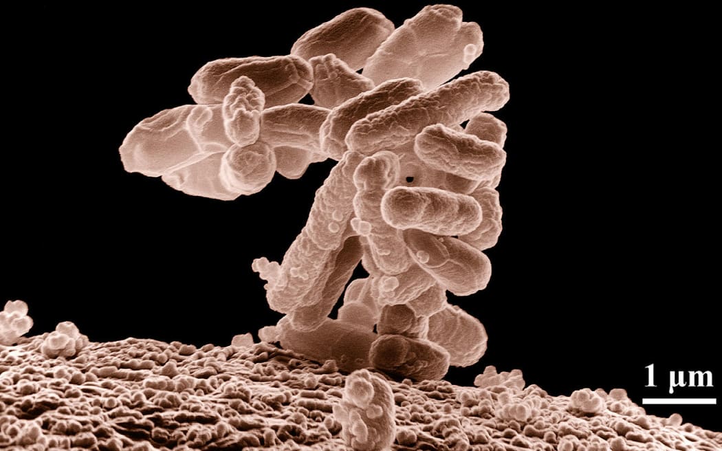 A cluster of Escherichia coli bacteria magnified 10,000 times