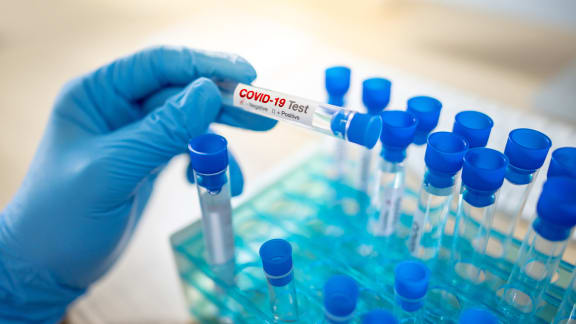 Medical scientist hand with blue sterile rubber gloves holding COVID-19 test tube in hospital laboratory. Male doctor or physician getting result of Coronavirus case.
