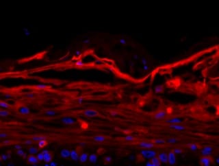 A cross-section of Upside’s engineered skin product, PelliCel® with immunohistochemical stains showing the top layer, epidermis in red and the lower, dermal layer in blue. (Supplied)