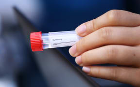 Sample bottle for collecting saliva specimens at a Covid-19 testing station in Hong Kong.