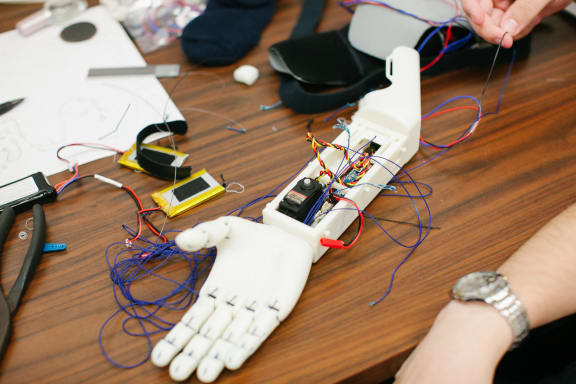 Prosthetic arm deals using arduino
