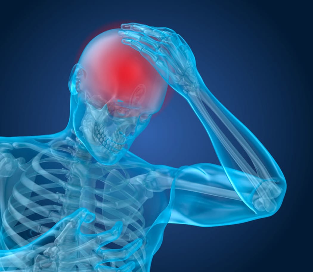University of Otago researchers are studying rugby players who have experienced multiple bouts of concussion.