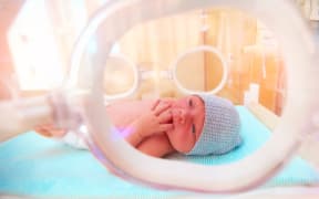 A premature baby in an incubator.