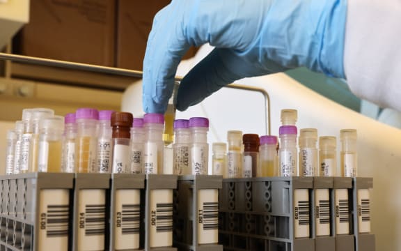 SEATTLE, WA - FEBRUARY 12: Researchers at the UW Medicine Retrovirology Research Lab at Harborview Medical Center work on samples from the Novavax phase 3 Covid-19 clinical vaccine trial on February 12,