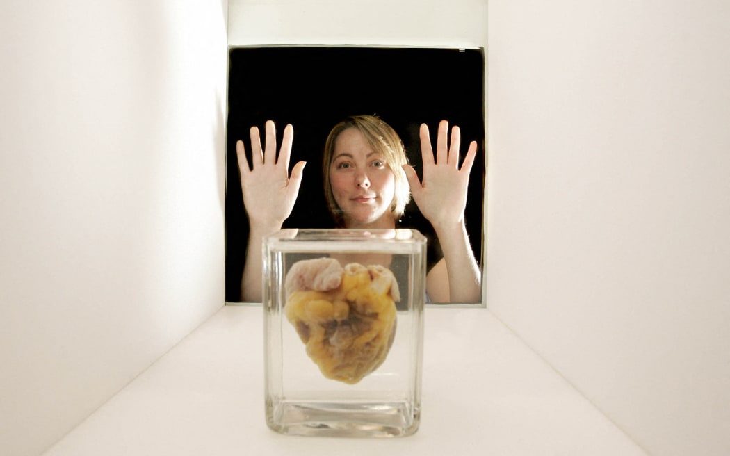 Heart transplant patient Jennifer Sutton comes face to face with her own heart at the Wellcome Collection's Heart Exhibition in central London, 04 September 2007. Jennifer, 23, had a heart transplant at the Papworth Hospital, Cambridge, on 04 June 2007, and gave her heart to the Wellcome Collection to increase public awareness about organ donation and Restrictive Cardiomyopathy, the disease that could have ended her life. (Photo by SHAUN CURRY / AFP)