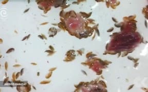 What ate Sam's legs