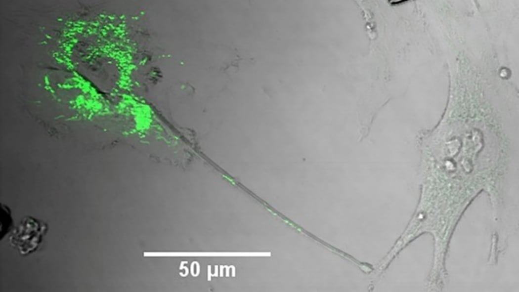 Brain cells (astrocyte) stained green with GFP dye shows a "nanotube" with green punctate mitochondria moving from a donor cell into a recipient cell.