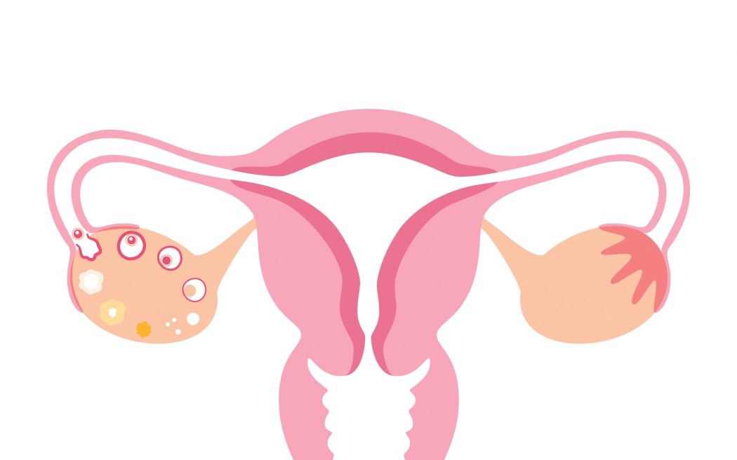 Female reproductive organs, illustration. (Photo by PIKOVIT / SCIENCE PHOTO LIBRARY / TPA / Science Photo Library via AFP)