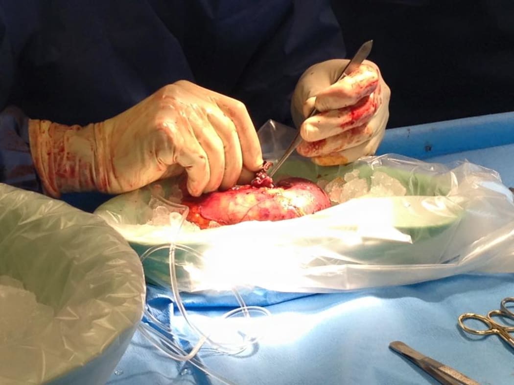 The kidney that Rachel Rouge donated. AKA " Bert"