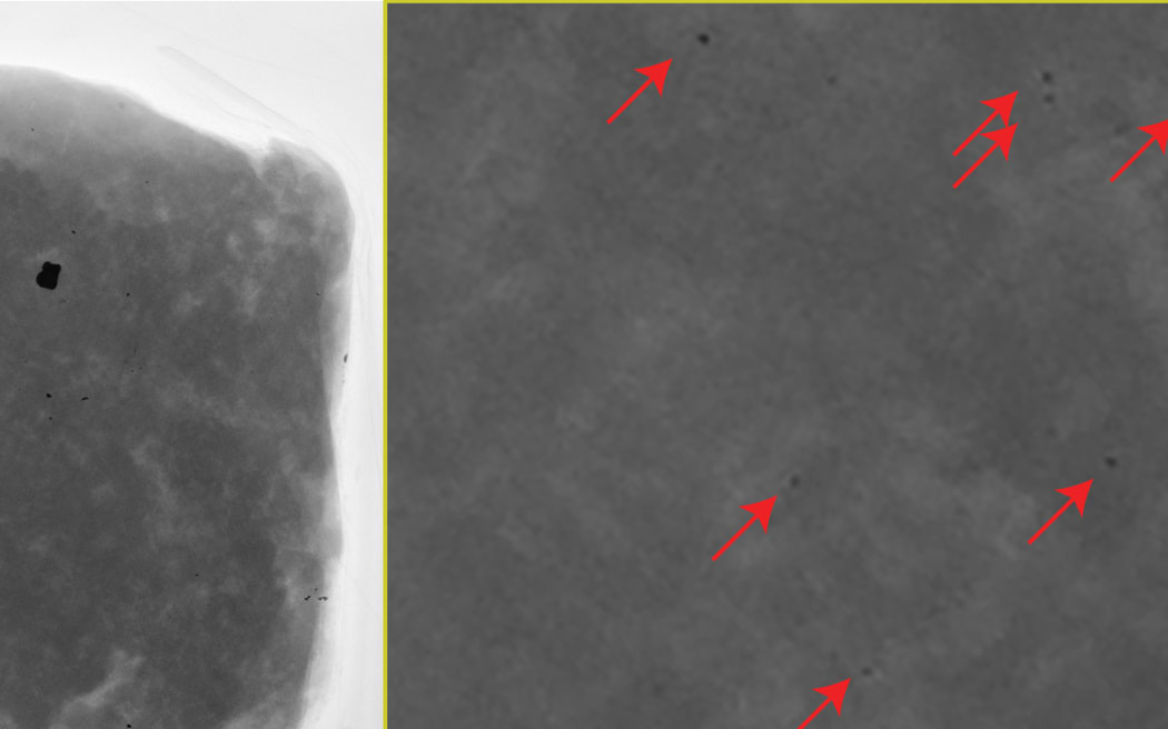 Lead particles detected in mince meat of an animal shot with lead ammunition.