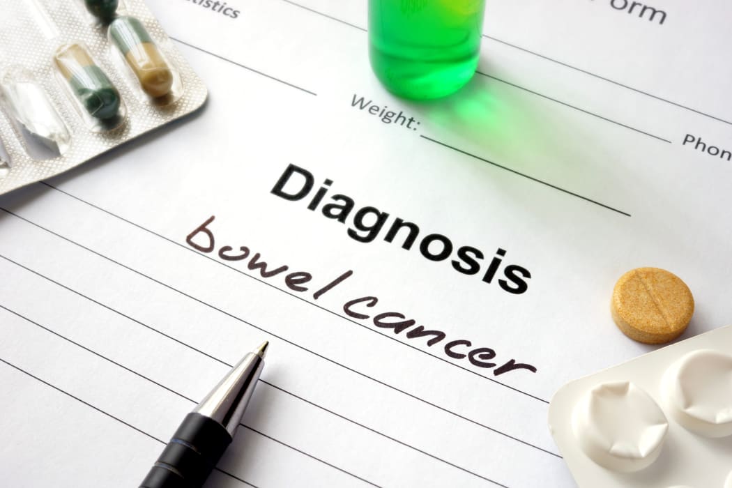 Bowel Cancer stock photo