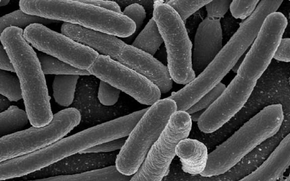 Escherichia coli, one of the many species of bacteria present in the human gut