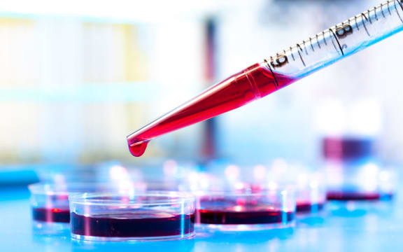 Scientists are one step closer to a universal blood test for cancer.