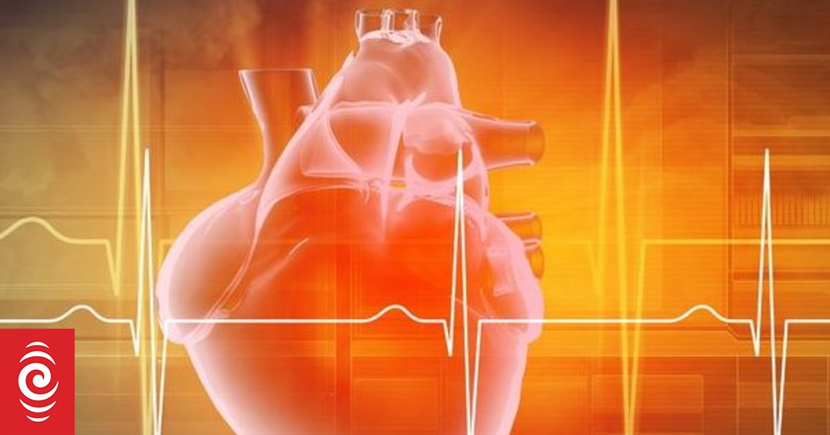 Deaths from heart disease highest in regions with fewest cardiac staff – research