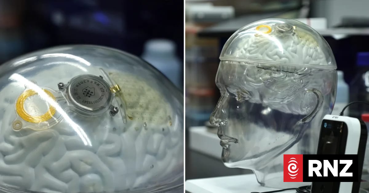 China is catching up to the US in brain tech, rivaling firms like Elon ...