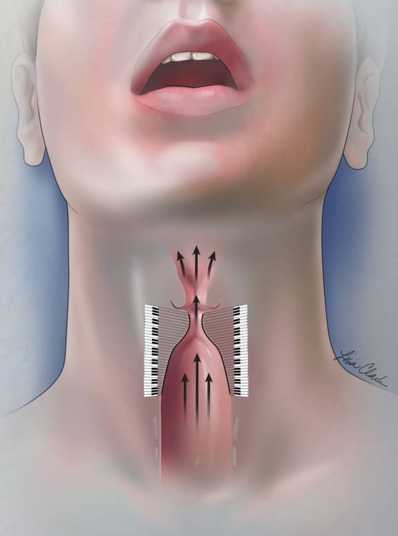 vocal chords illustration