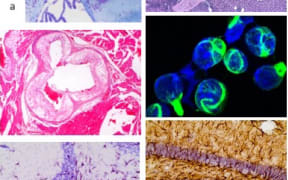 Auto immunity image collage