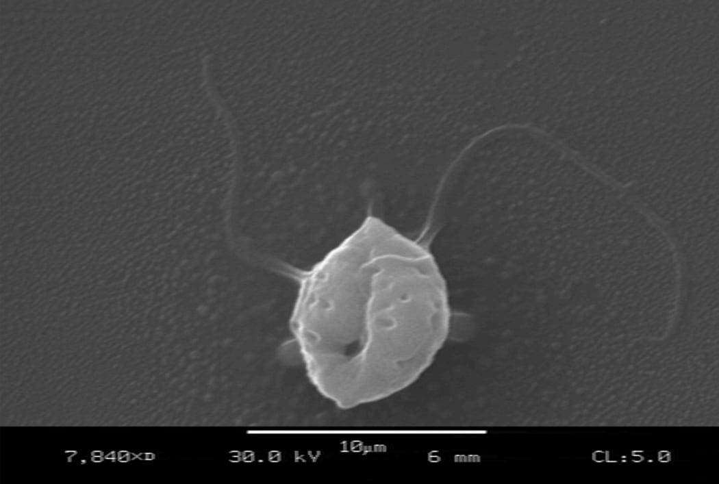 Zoospore with two tail-like flagellum