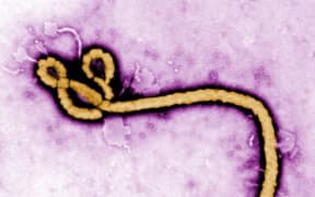 Ebola Virus up close