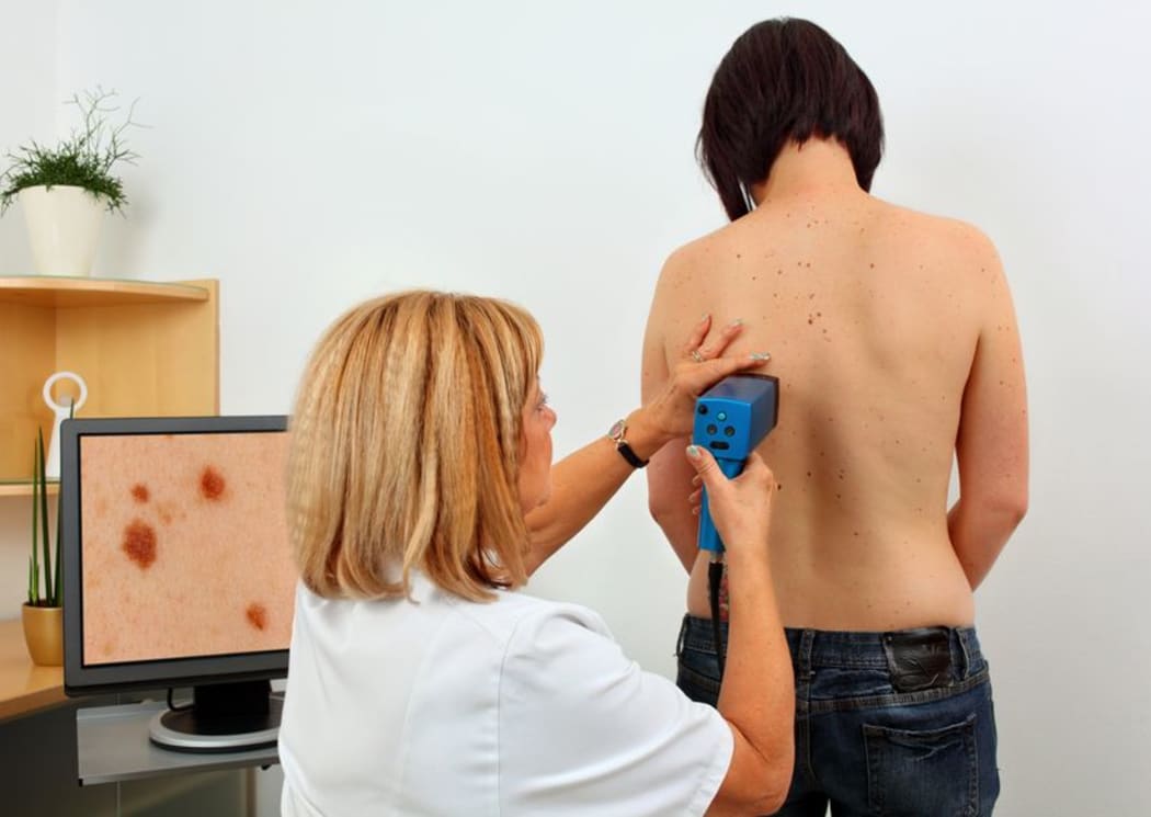 New Zealand has 50 cases per 100,000 people and rising, say researchers.
