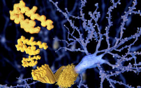 Amyloid Beta