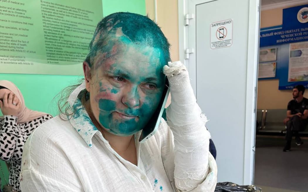 This handout picture released on July 4, 2023 by Sergei Babinets, the head of the Crew Against Torture, shows Russian investigative journalist Elena Milashina speaking on a mobile phone at a hospital in the Chechen capital Grozny.