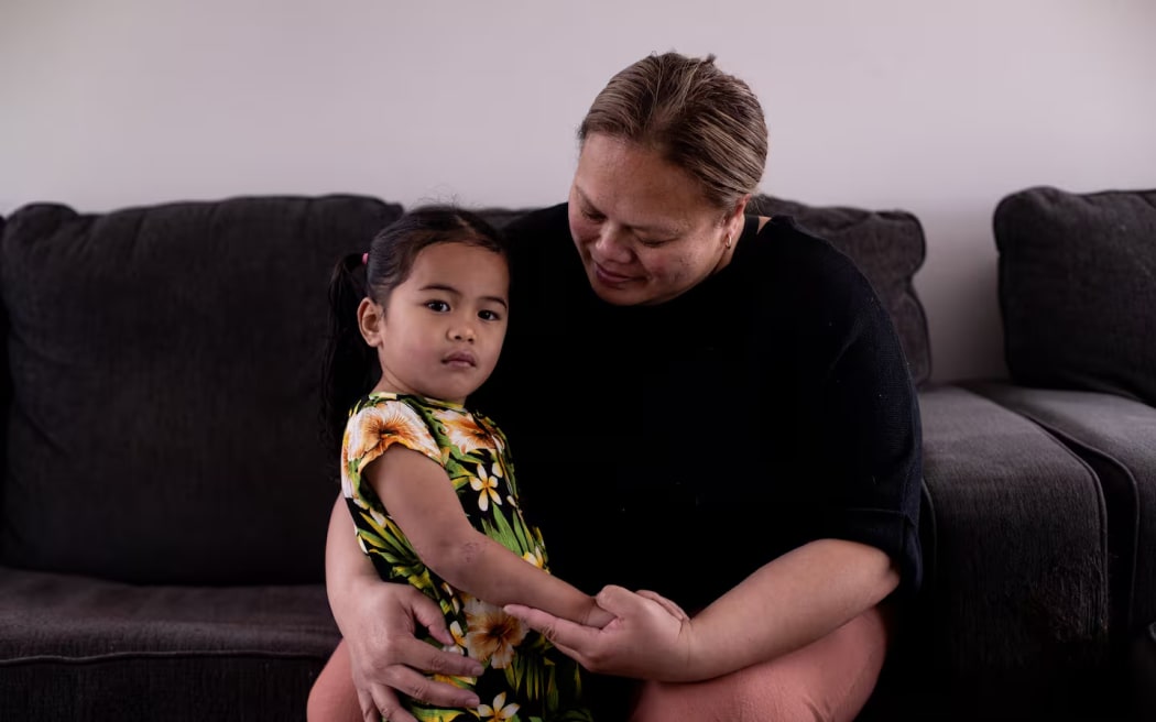 Helena Paul with her youngest daughter, 3-year-old Monica, who has eczema.