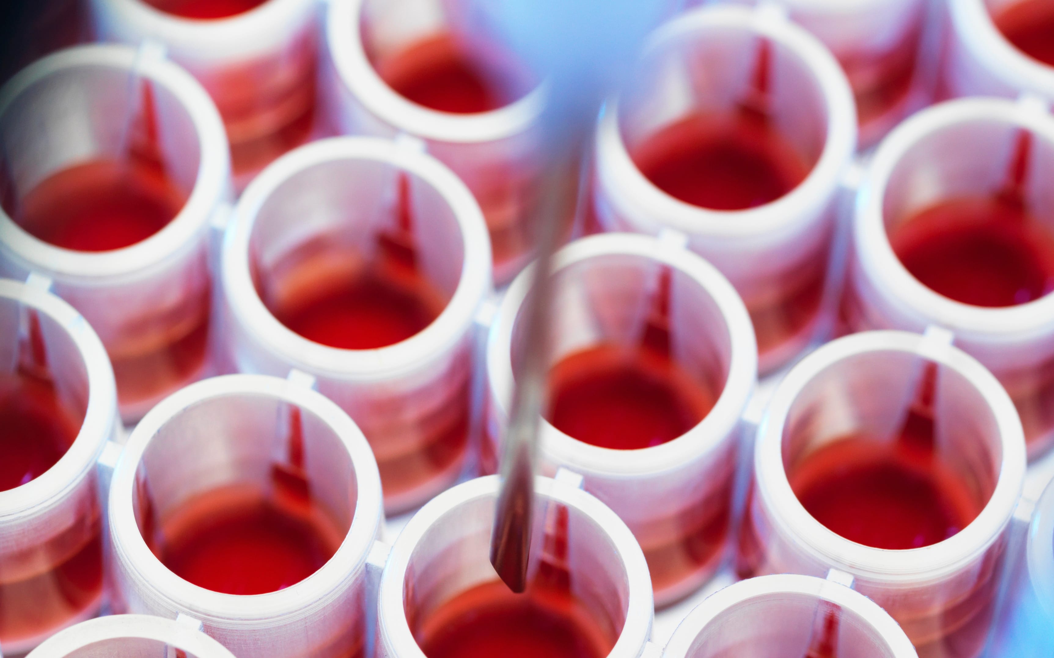 Blood test