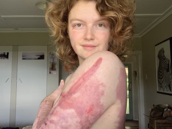 Kelsey Waghorn in hospital 2020.