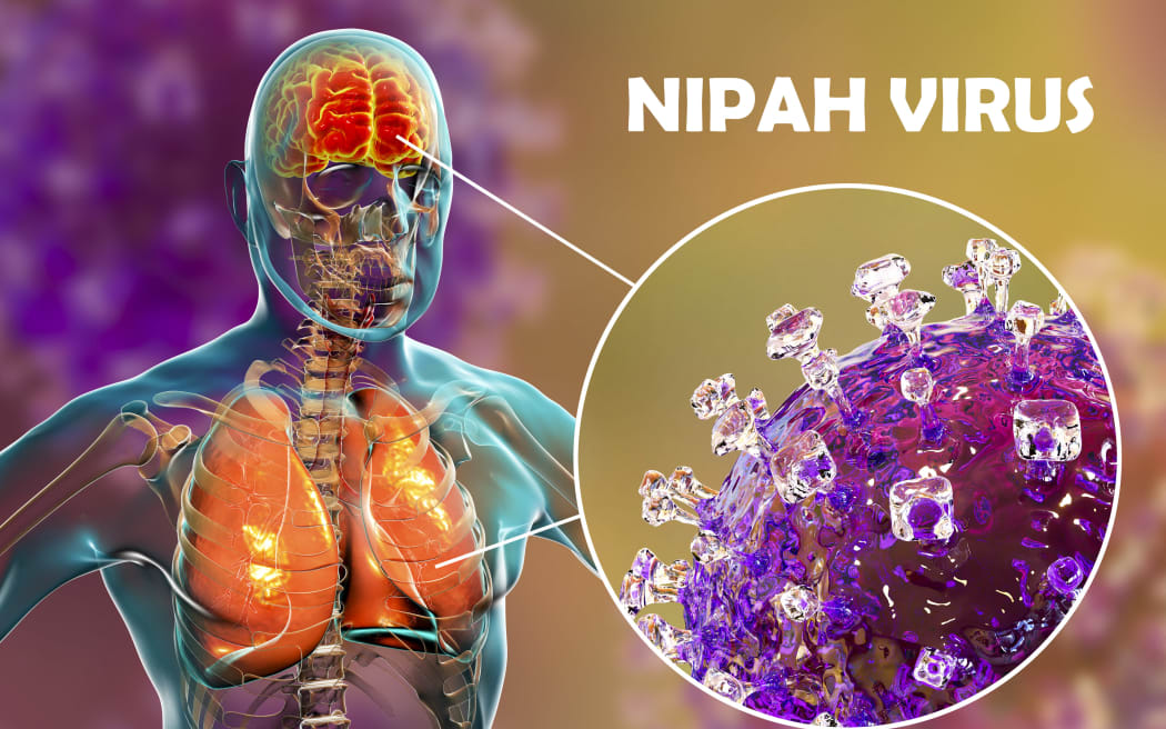 Encephalitis and pneumonia caused by Nipah viruses, computer illustration. Nipah virus is zoonotic (transmitted to humans from animals) and was first found in Malaysia and Singapore in people who had close contact with pigs. It was initially isolated in 1999 upon examining samples from an outbreak of encephalitis and respiratory illness among adult men in those two countries. (Photo by KATERYNA KON/SCIENCE PHOTO LIBRA / KKO / Science Photo Library via AFP)