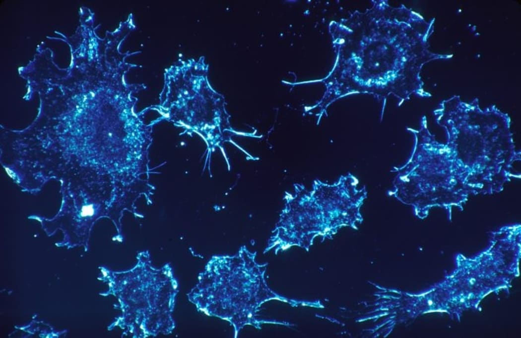 Nanoparticles engineered to image and treat cancer