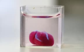 This photo from the University of Tel Aviv shows a 3D print out of a heart with human tissue.