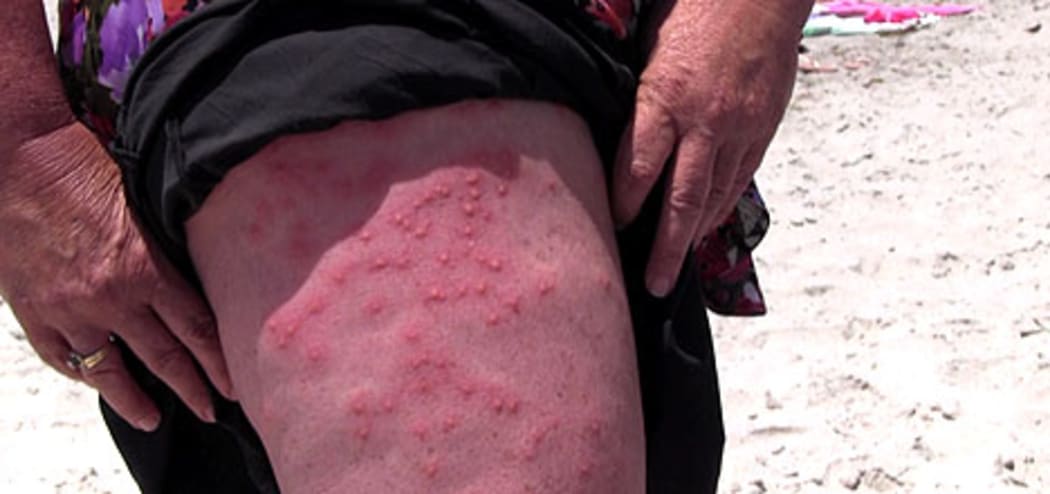 The impact of the Phycosecis Limbata AKA Mount Mauler/ This image was taken from Sunlive.co.nz