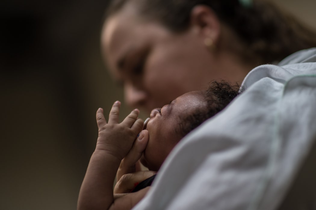 A physiotherapist in Brazil holds a baby suffering from microcephalia.