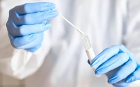 Doctor holding swab test tube for 2019-nCoV analyzing. Coronavirus test. Blue medical gloves and protective face mask for protection against covid-19 virus. Coronavirus and pandemic