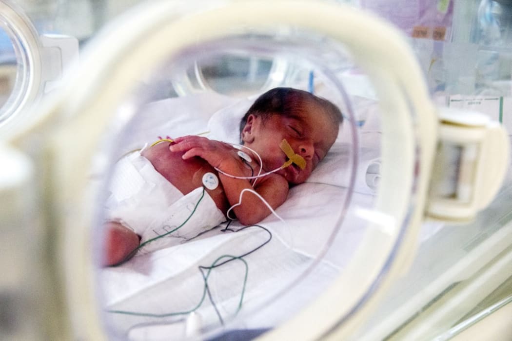 Premature baby in the Neonatology ward at St Vincent de Paul hospital, run by the Daughters of Charity catholic missionaries in Nazareth, Israel.