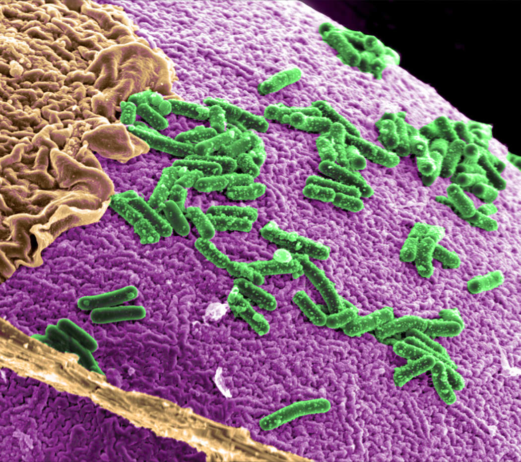 Microbes in a slice of a biofilm.