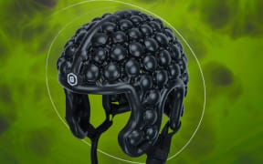 Scientists are testing if this helmet could prevent concussion.