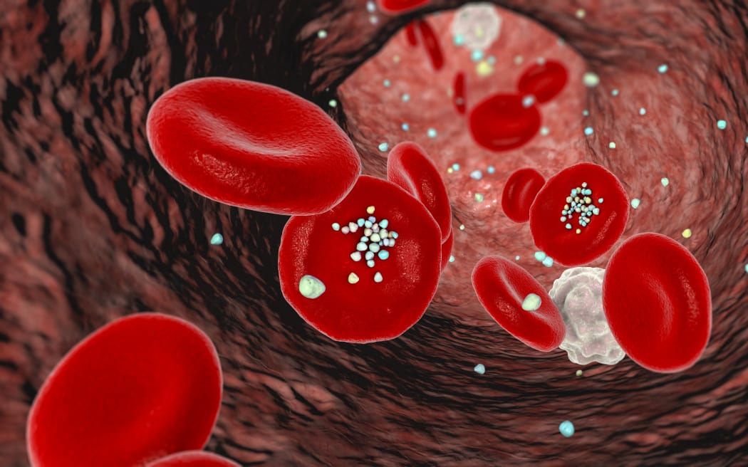 Erythrocyte interaction with plastic microparticles in blood. computer illustration showing particles movement and deposition after entering bloodstream via ingestion, inhalation, or absorption. (Photo by KATERYNA KON/SCIENCE PHOTO LIBRA / KKO / Science Photo Library via AFP)