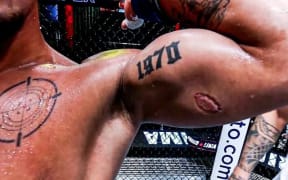 UFC fighter Andre Lima shows off the bite mark which ultimately earnt him $US50,000.