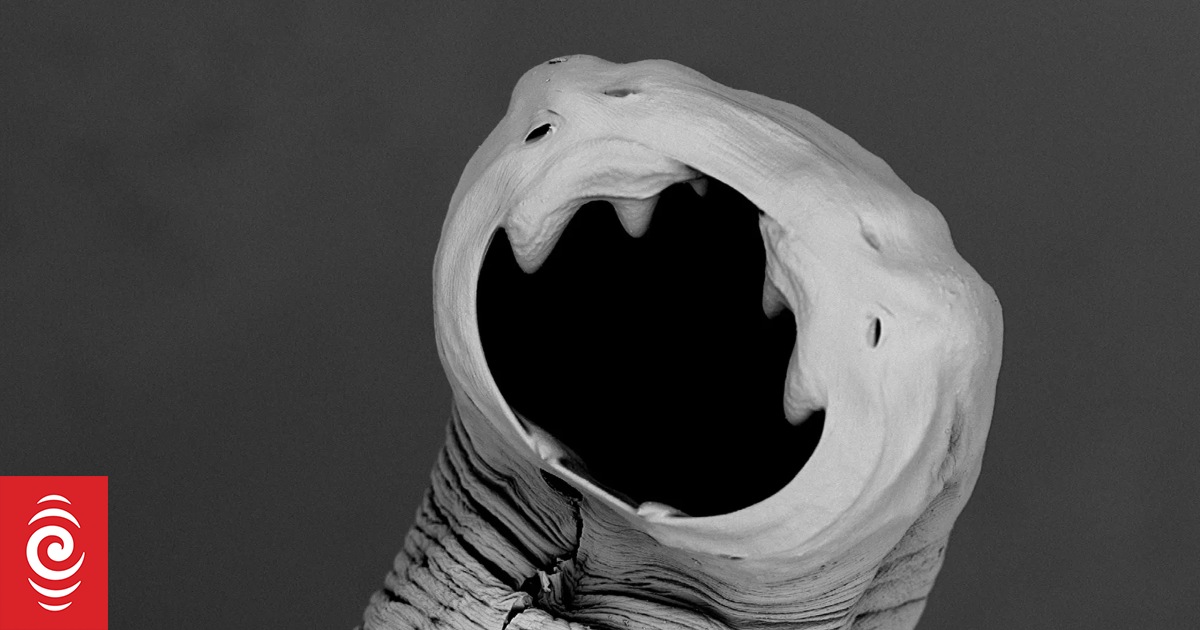 Infection with benefits: How playing host to hookworms could be good for you - Vimarsana News