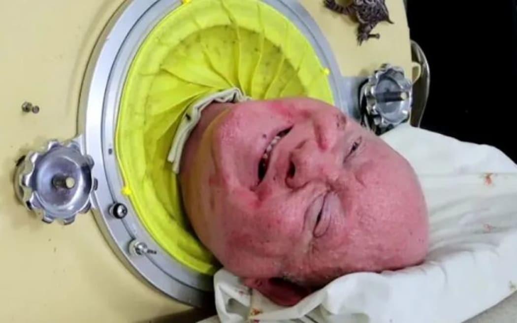 Paul Alexander, Man in the Iron Lung
