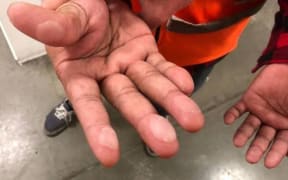 This image of a Sistema worker with blistered hands has been handed out at many distributing stores.
