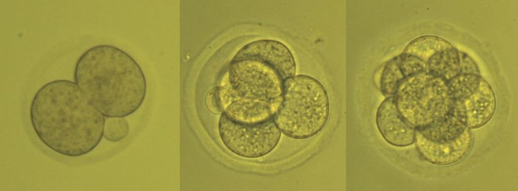 Fertility researcher Melanie Olds photographed a very early embryo as it doubled from two to eight cells.