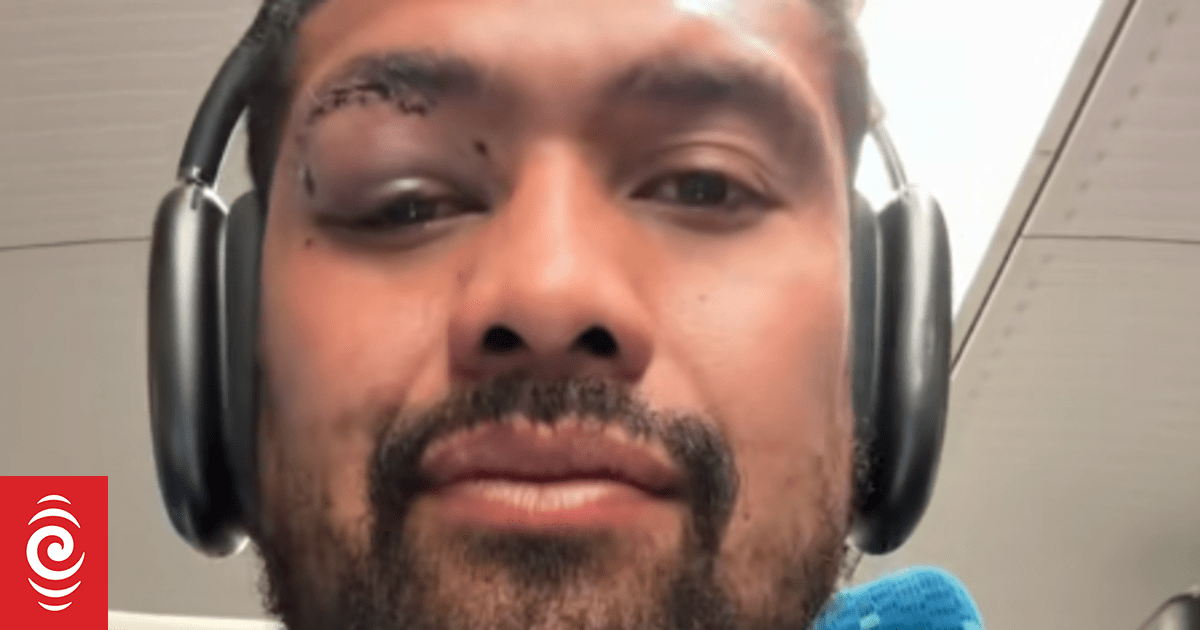 Ardie Savea sports nasty eye injury