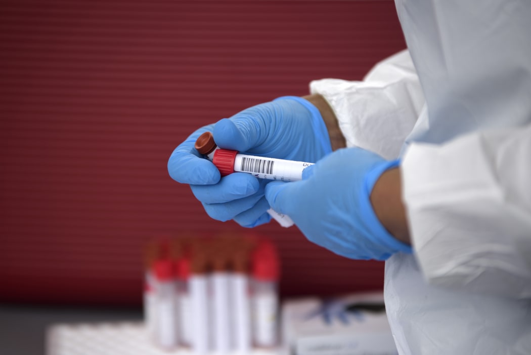 A healthcare worker organises Covid-19 tests that were just administered at United Memorial Medical Center Covid-19 testing site in Houston, Texas Thursday,25 June.