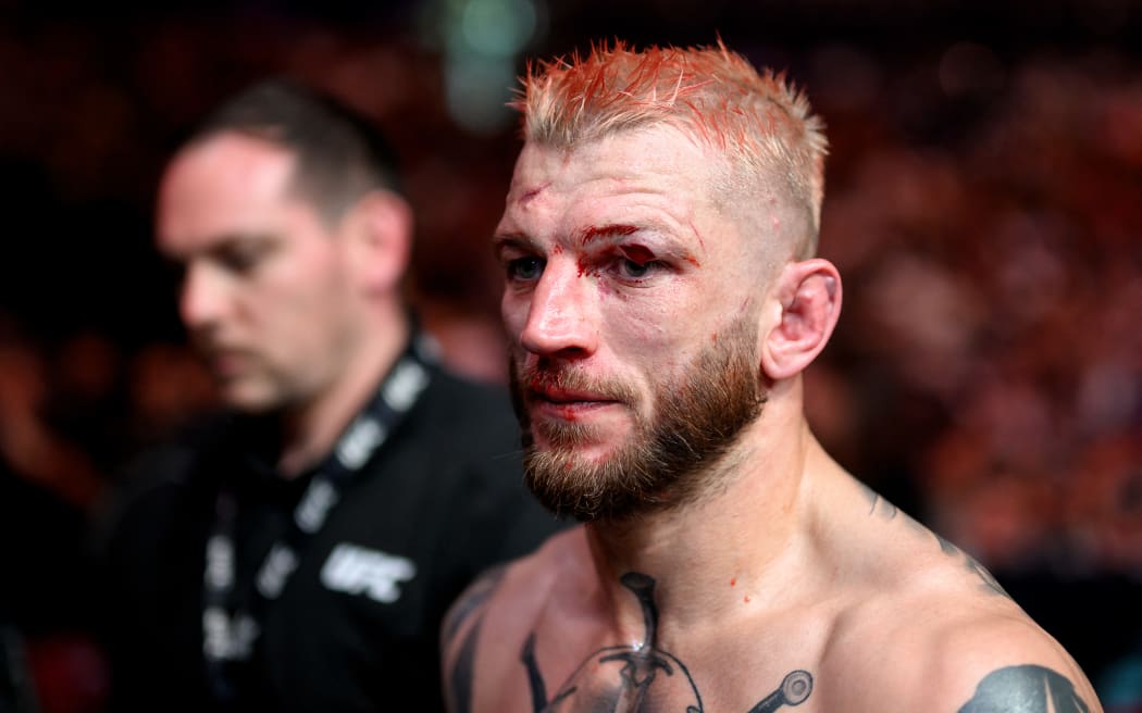 New Zealand’s Dan Hooker looks on after his fight against France’s Benoit Saint Denis during the Ultimate Fighting Championship (UFC) 325 at Qudos Bank Arena in Sydney on February 1, 2026. (Photo by STEVEN MARKHAM / AFP) / --IMAGE RESTRICTED TO EDITORIAL USE - STRICTLY NO COMMERCIAL USE--